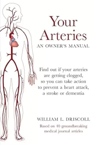 Your Arteries-An Owner's Manual: Find Out If Your Arteries Are Getting Clogged, So You Can Take Action to Prevent a Heart Attack, a Stroke or Dementia